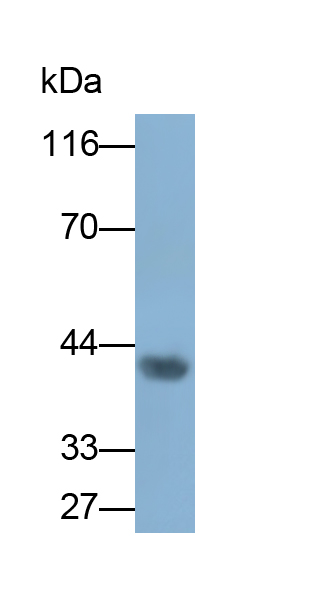 Monoclonal Antibody to Alpha-1-Acid Glycoprotein (a1AGP)
