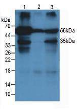 Monoclonal Antibody to Alpha-1-Acid Glycoprotein (a1AGP)