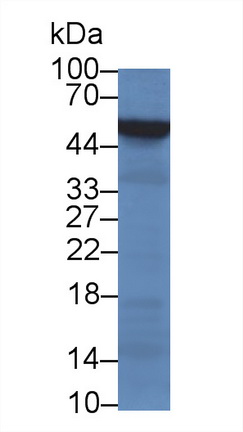 Monoclonal Antibody to Alpha-1-Acid Glycoprotein (a1AGP)