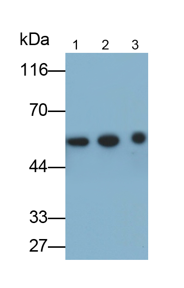 Monoclonal Antibody to Alpha-1-Acid Glycoprotein (a1AGP)
