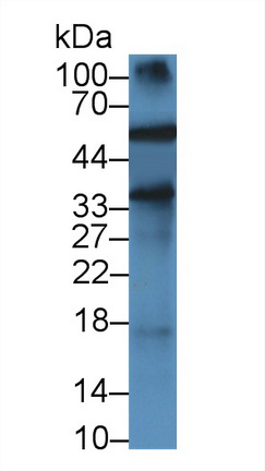 Monoclonal Antibody to Alpha-1-Acid Glycoprotein (a1AGP)