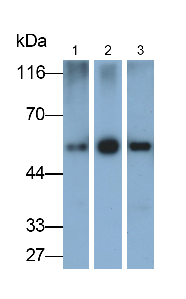Monoclonal Antibody to Alpha-1-Acid Glycoprotein (a1AGP)