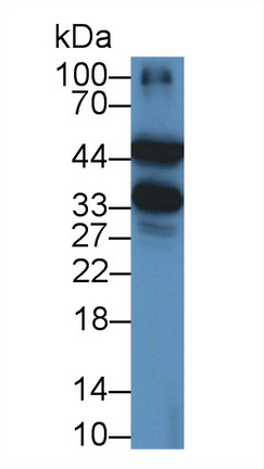 Monoclonal Antibody to Alpha-1-Acid Glycoprotein (a1AGP)