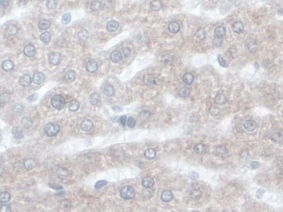 Monoclonal Antibody to Alpha-1-Acid Glycoprotein (a1AGP)