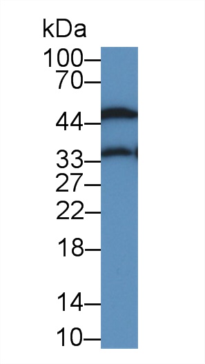 Monoclonal Antibody to Alpha-1-Acid Glycoprotein (a1AGP)