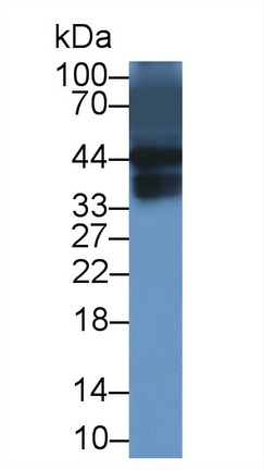 Monoclonal Antibody to Alpha-1-Acid Glycoprotein (a1AGP)