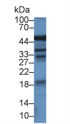 Monoclonal Antibody to Alpha-1-Acid Glycoprotein (a1AGP)