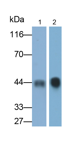Monoclonal Antibody to Alpha-1-Acid Glycoprotein (a1AGP)