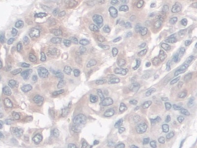 Monoclonal Antibody to Haptoglobin (Hpt)