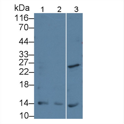 Monoclonal Antibody to Parathyroid Hormone Related Protein (PTHrP)