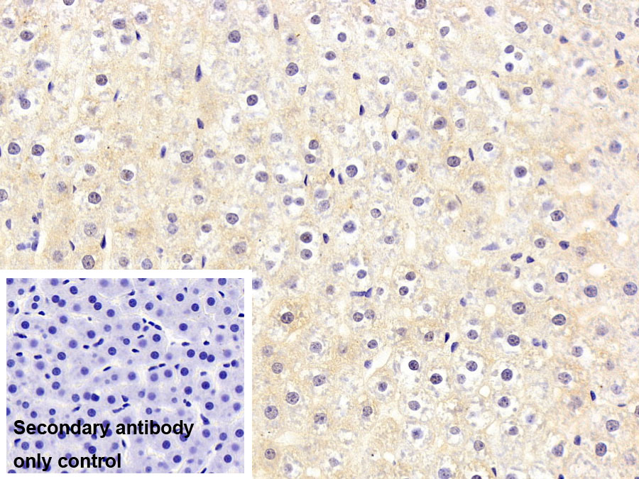 Monoclonal Antibody to Coagulation Factor II (F2)