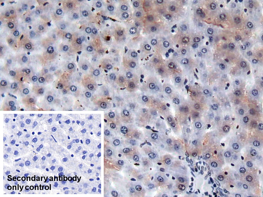 Monoclonal Antibody to Coagulation Factor II (F2)