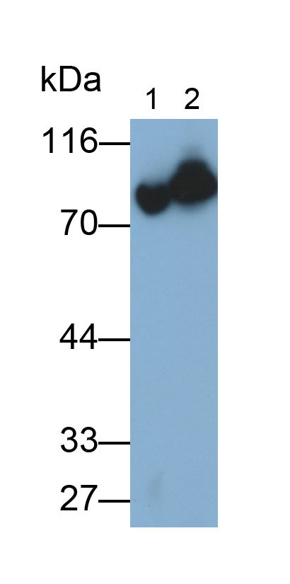 Monoclonal Antibody to Coagulation Factor II (F2)