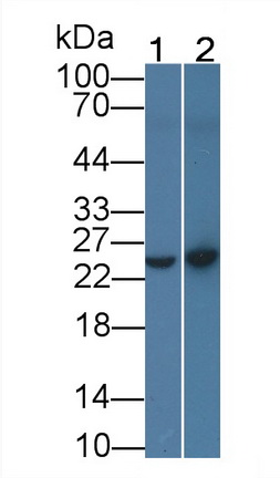 Monoclonal Antibody to C Reactive Protein (CRP)