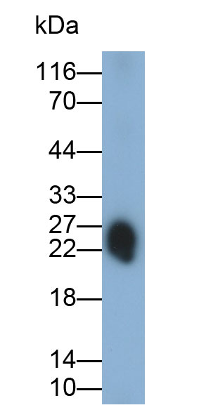 Monoclonal Antibody to C Reactive Protein (CRP)