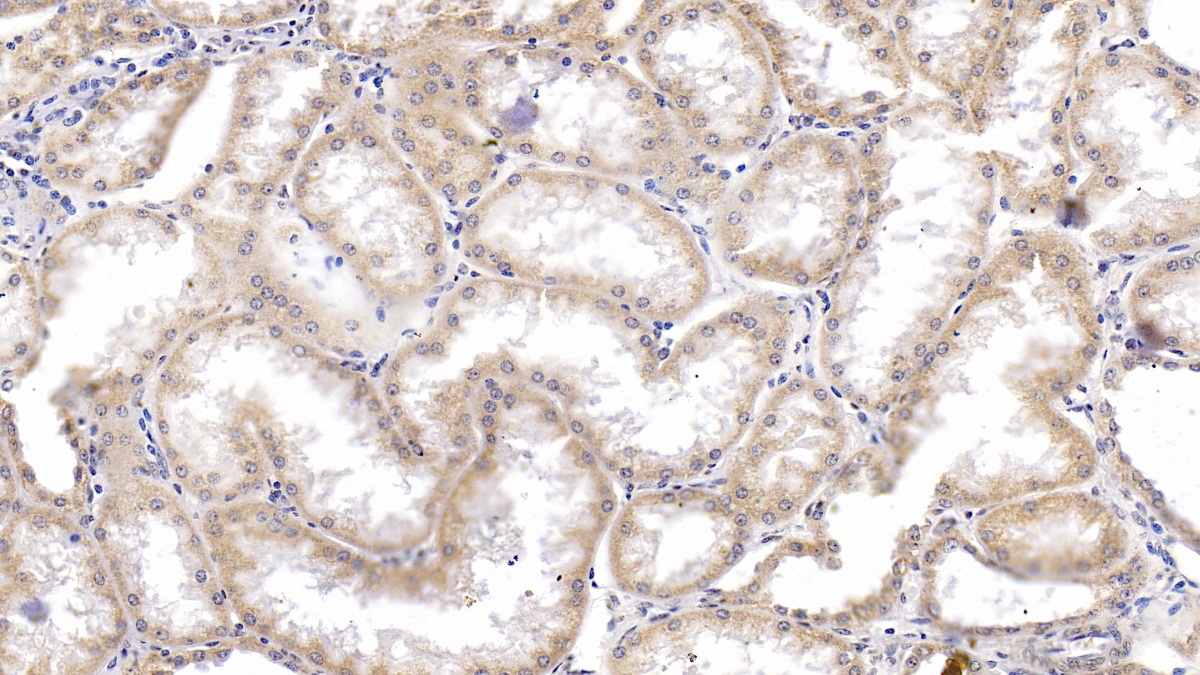 Monoclonal Antibody to Heat Shock Protein 60 (Hsp60)