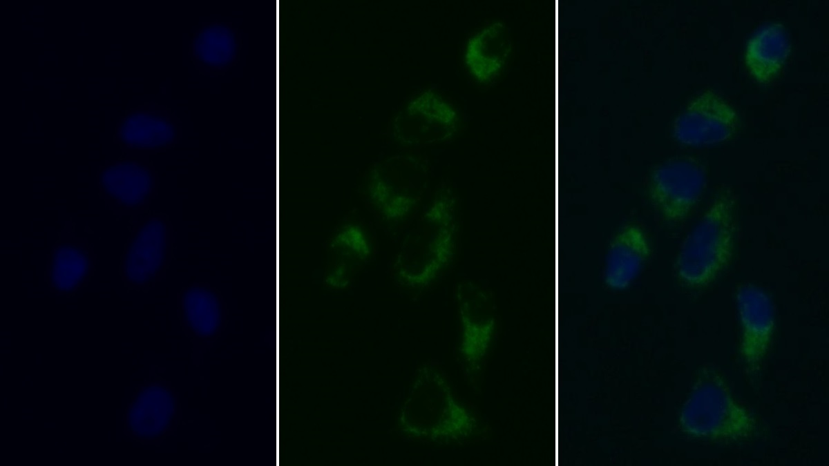 Monoclonal Antibody to Heat Shock Protein 60 (Hsp60)