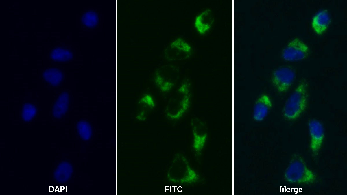 Monoclonal Antibody to Heat Shock Protein 60 (Hsp60)