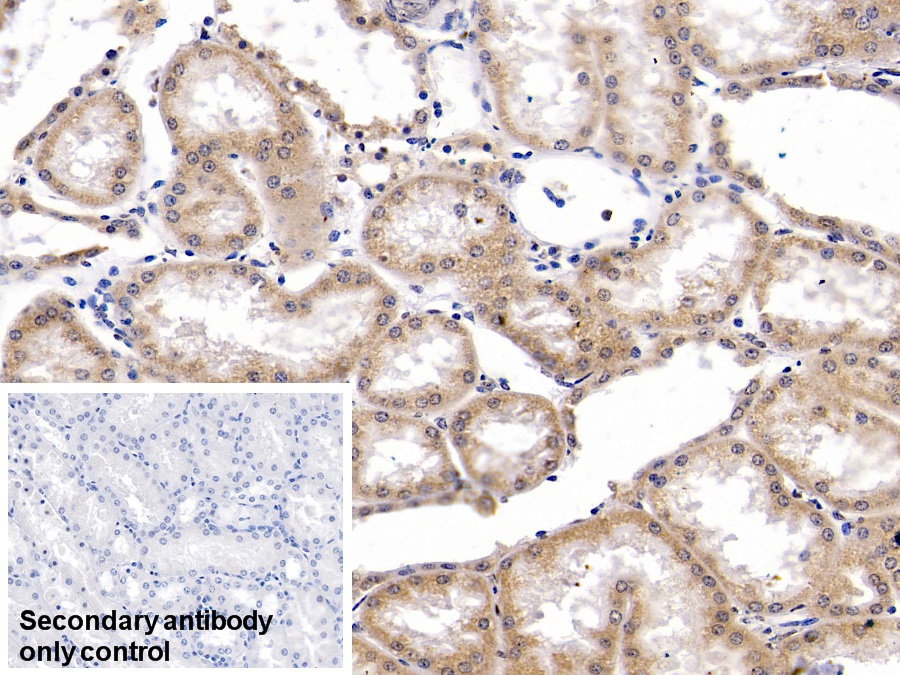 Monoclonal Antibody to Heat Shock Protein 60 (Hsp60)