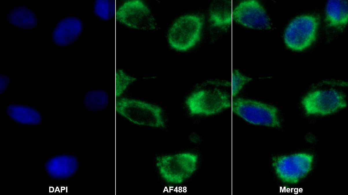 Monoclonal Antibody to Heat Shock Protein 60 (Hsp60)