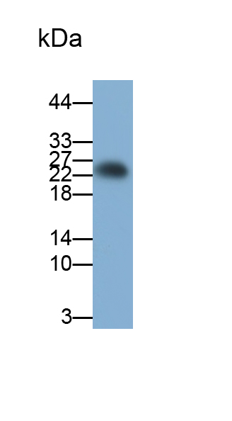 Monoclonal Antibody to Follicle Stimulating Hormone (FSH)