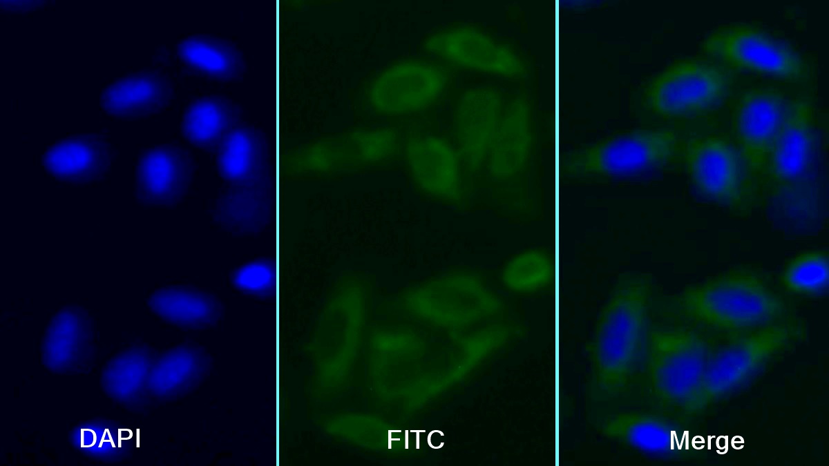 Monoclonal Antibody to Plasmin/Antiplasmin Complex (PAP)