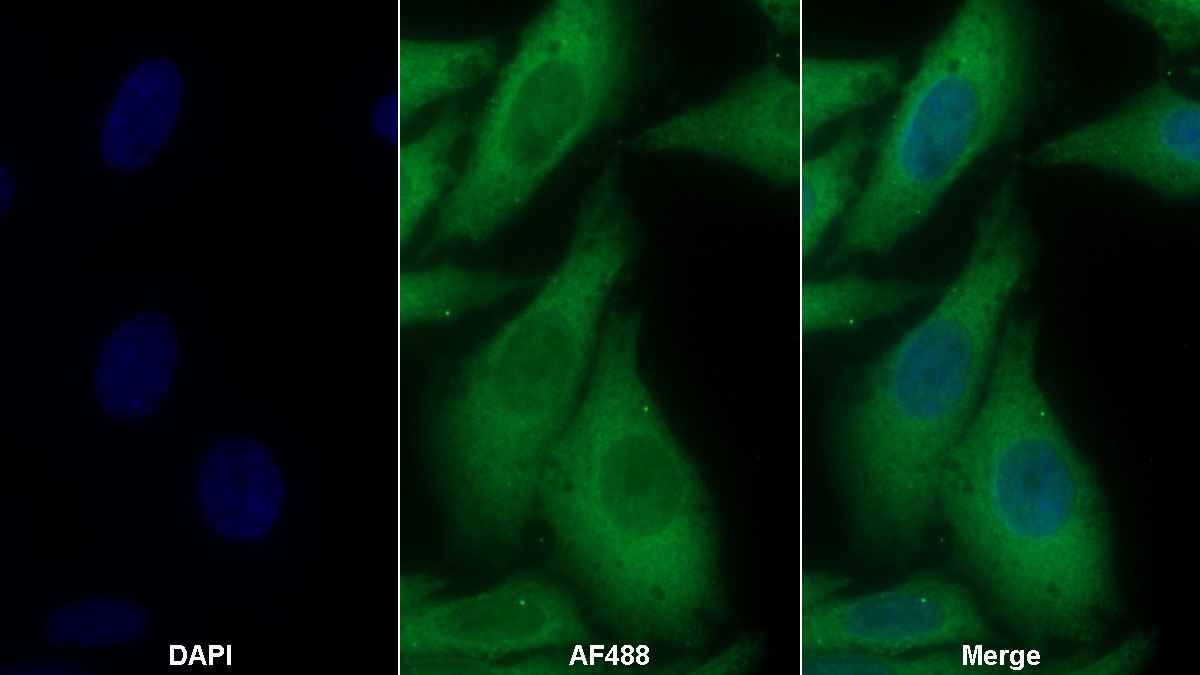 Monoclonal Antibody to Plasmin/Antiplasmin Complex (PAP)