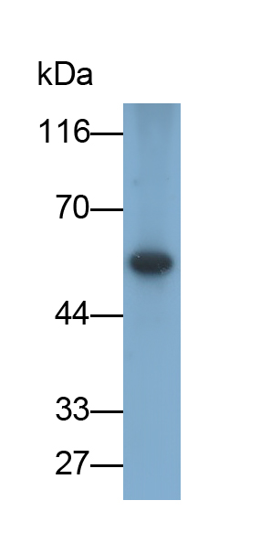 Monoclonal Antibody to Inhibin Beta A (INHbA)