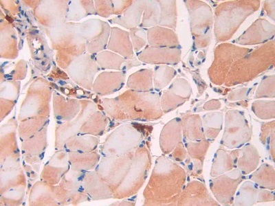 Monoclonal Antibody to Resistin (RETN)