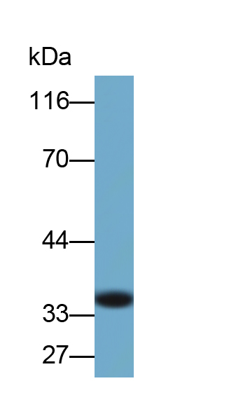 Monoclonal Antibody to Receptor Activator Of Nuclear Factor Kappa B Ligand (RANkL)