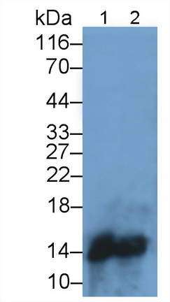 Monoclonal Antibody to Serum Amyloid A (SAA)