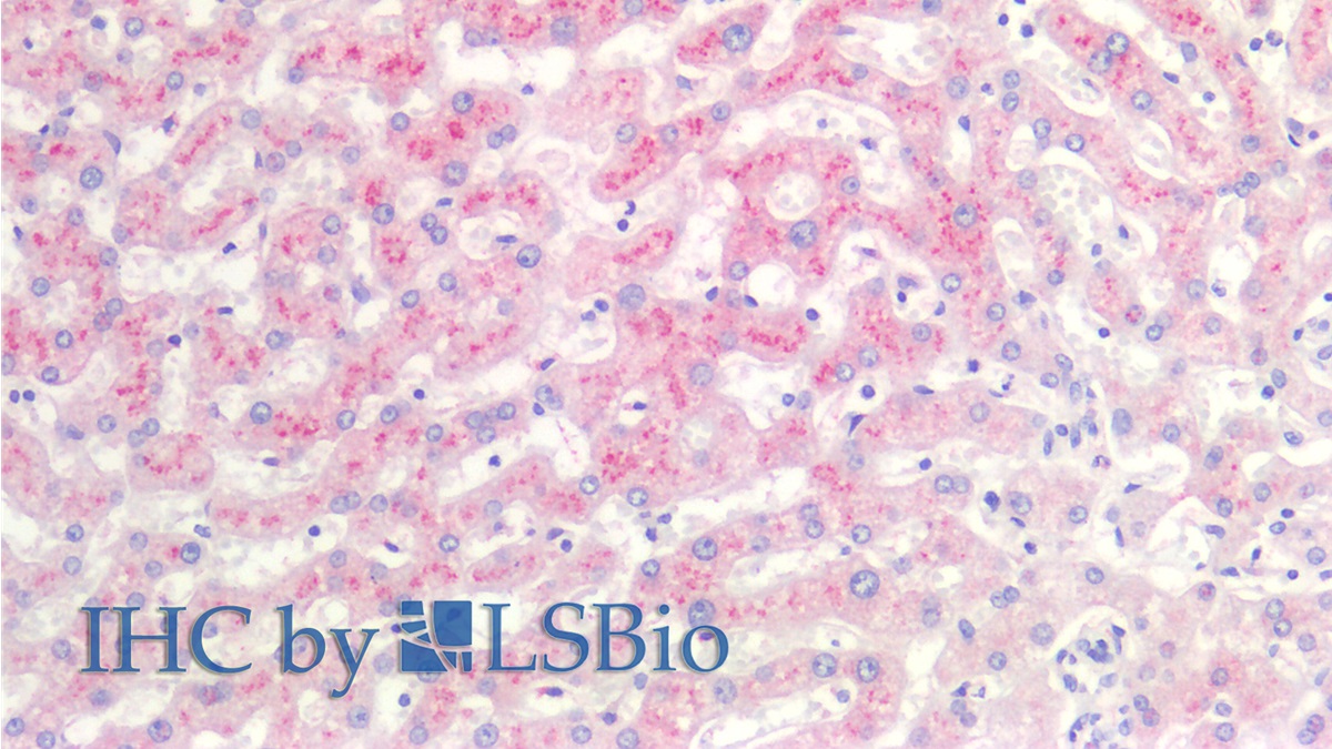 Monoclonal Antibody to Serum Amyloid A (SAA)