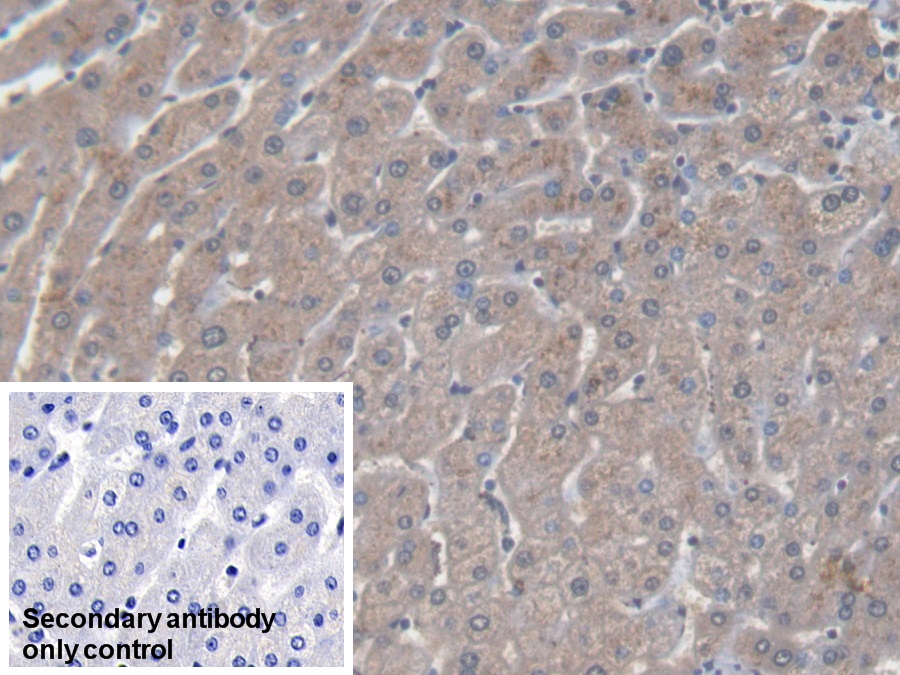 Monoclonal Antibody to Serum Amyloid A (SAA)