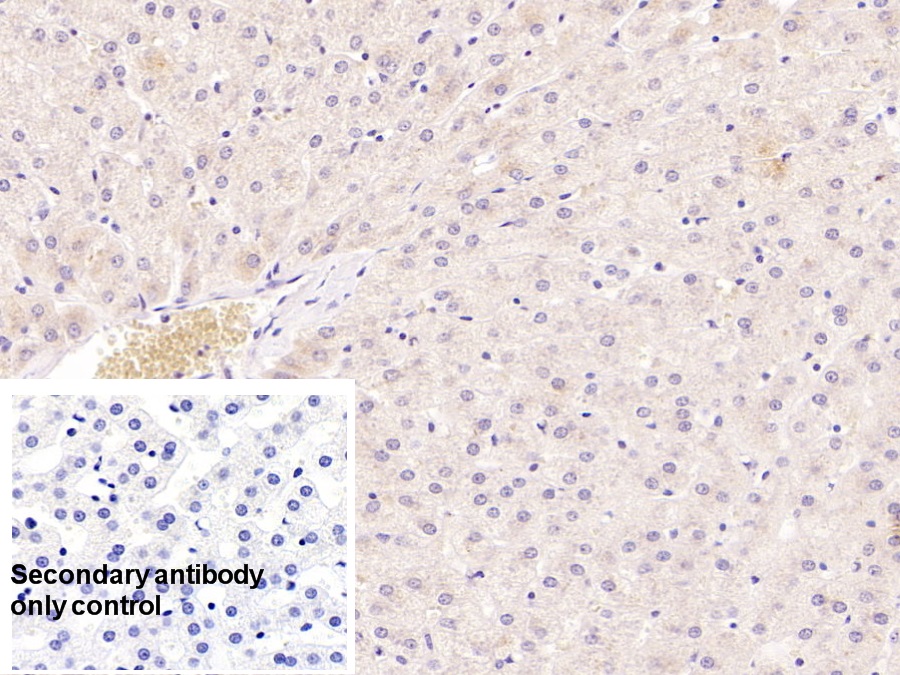 Monoclonal Antibody to Serum Amyloid A (SAA)
