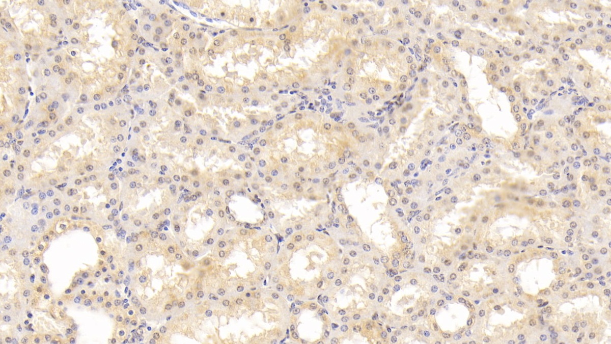 Monoclonal Antibody to Renin (REN)