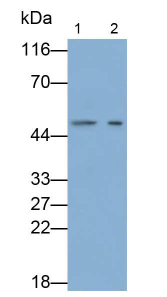 Monoclonal Antibody to Renin (REN)