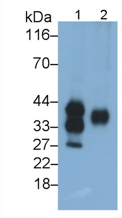 Monoclonal Antibody to Pulmonary Surfactant Associated Protein A1 (SFTPA1)