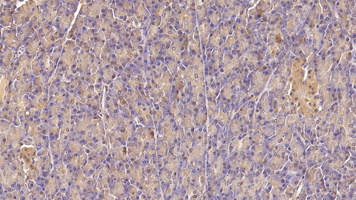 Monoclonal Antibody to Insulin Receptor (INSR)