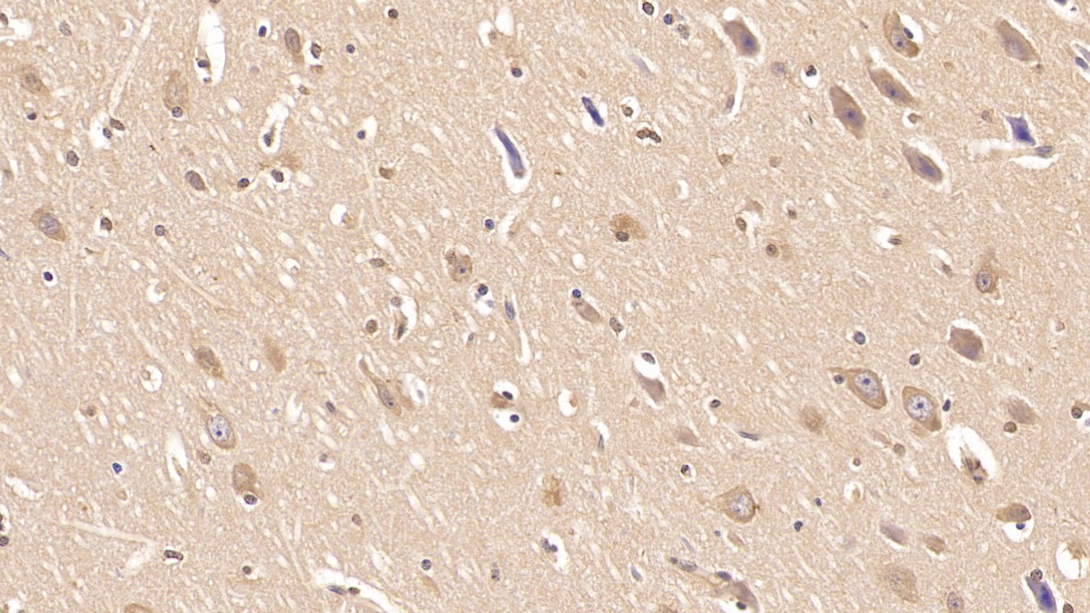 Monoclonal Antibody to Insulin Receptor (INSR)