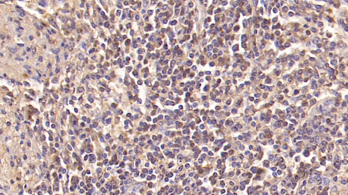 Monoclonal Antibody to Insulin Receptor (INSR)