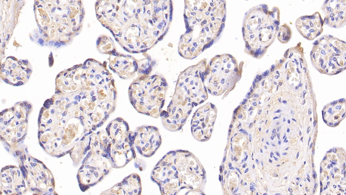 Monoclonal Antibody to Insulin Receptor (INSR)