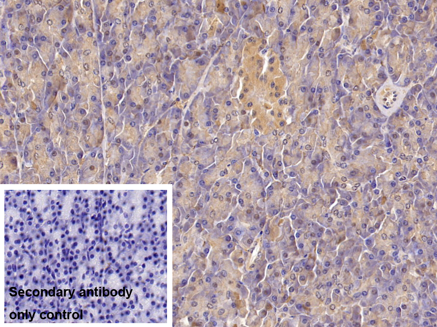 Monoclonal Antibody to Insulin Receptor (INSR)