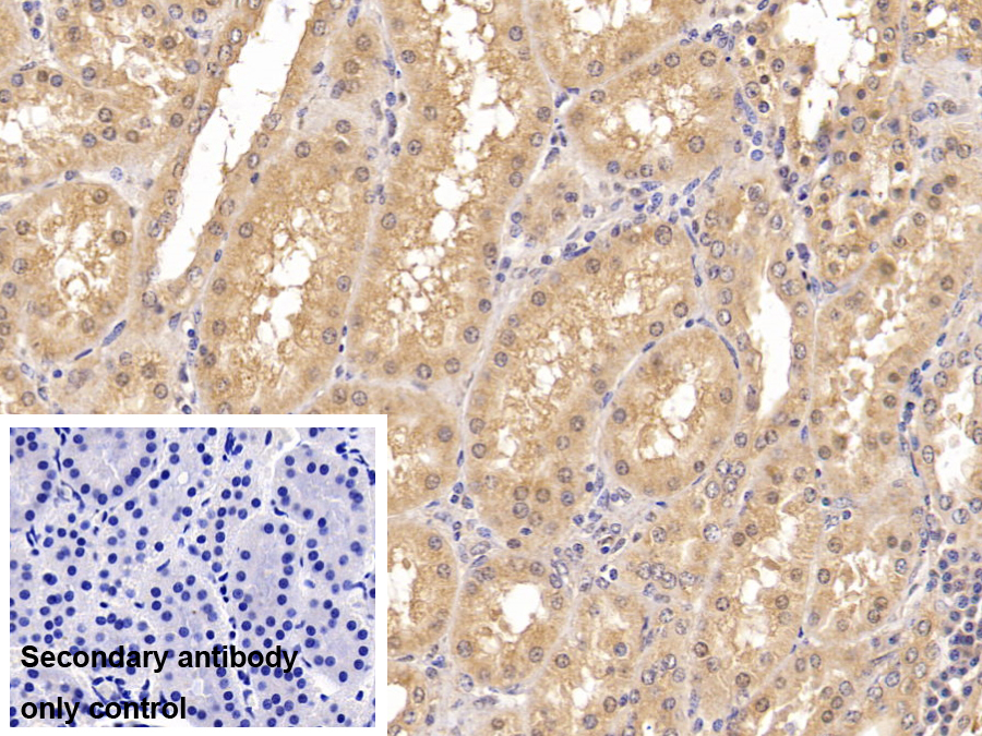 Monoclonal Antibody to Insulin Receptor (INSR)