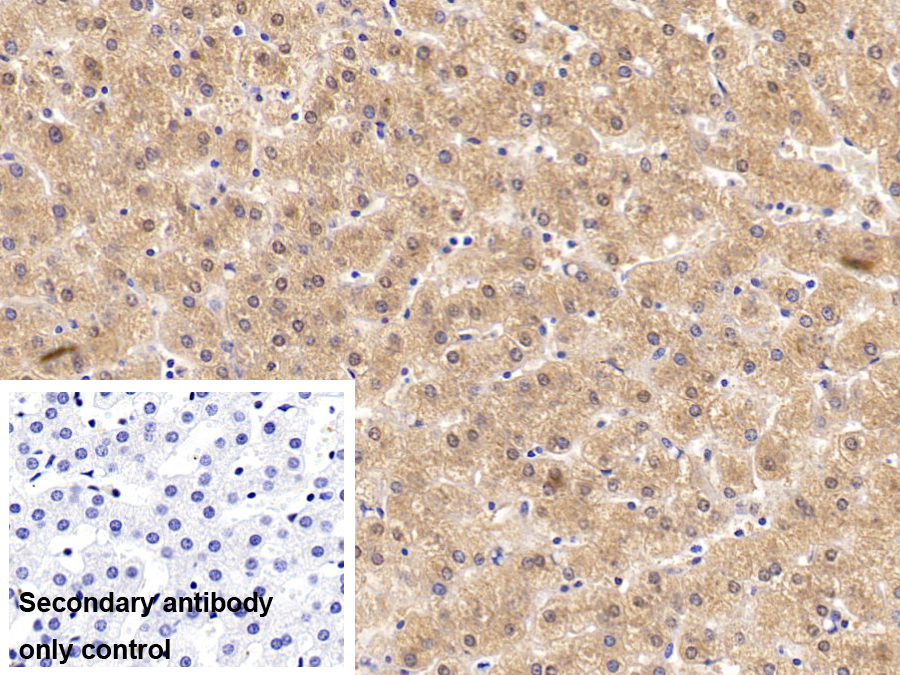 Monoclonal Antibody to Insulin Receptor (INSR)