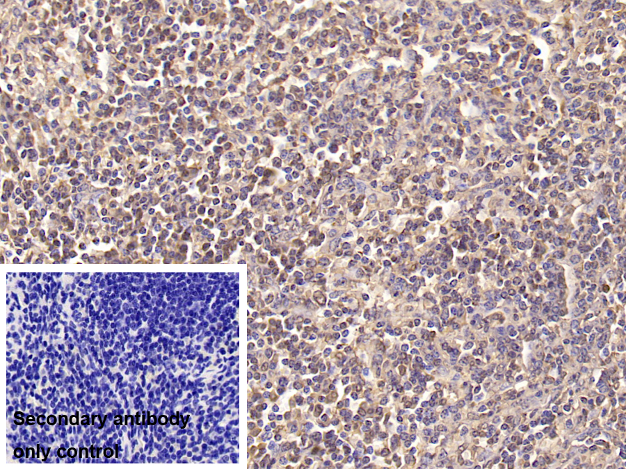 Monoclonal Antibody to Insulin Receptor (INSR)