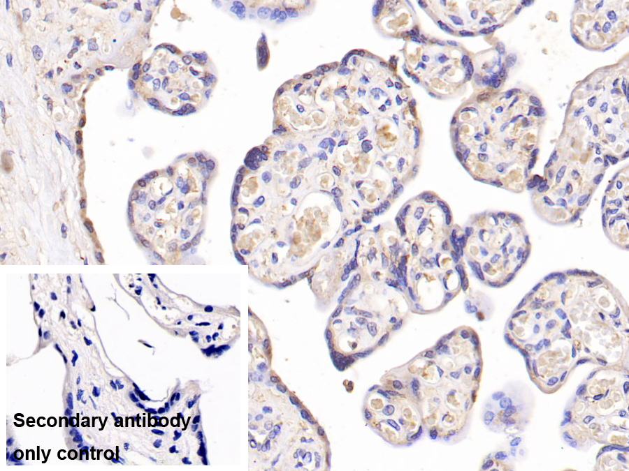 Monoclonal Antibody to Insulin Receptor (INSR)