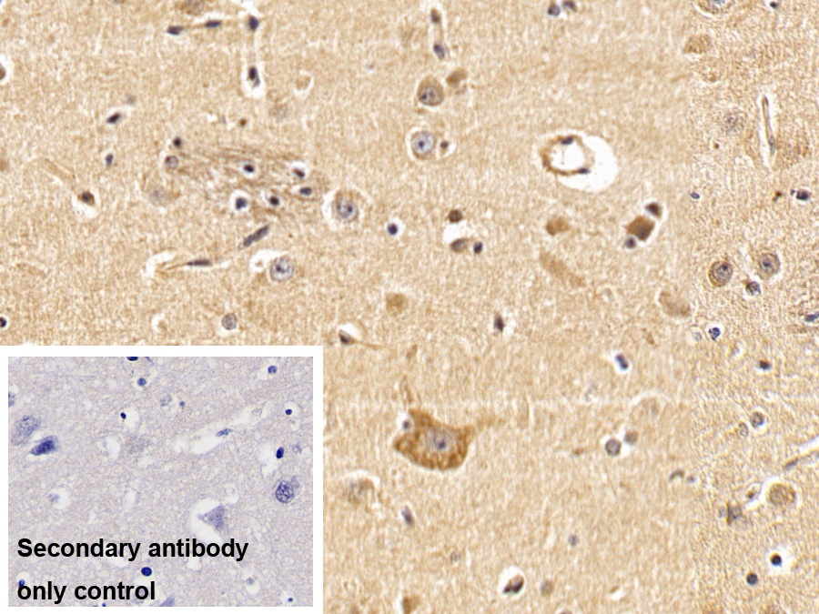 Monoclonal Antibody to Insulin Receptor (INSR)