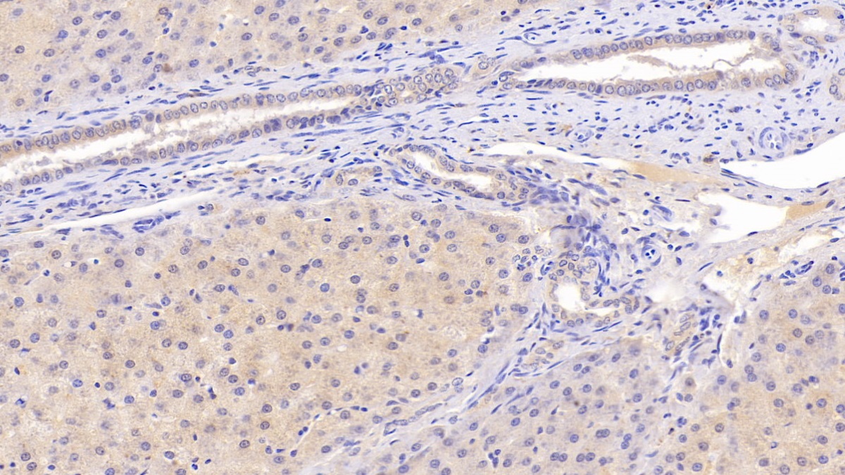 Monoclonal Antibody to Insulin Receptor (INSR)