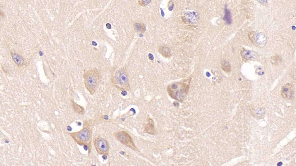 Monoclonal Antibody to Insulin Receptor (INSR)