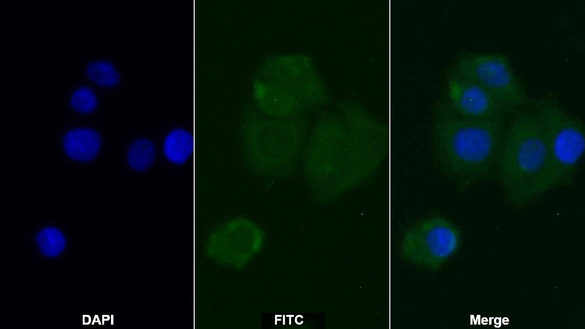 Monoclonal Antibody to Insulin Receptor (INSR)